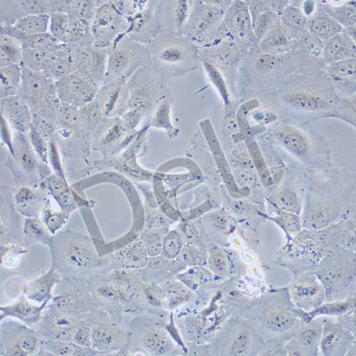 Caov-3 人卵巢腺癌細胞