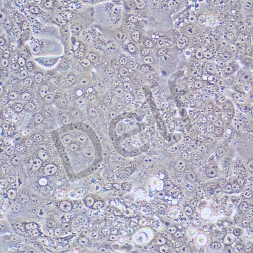 Capan-1 人胰腺癌細(xì)胞