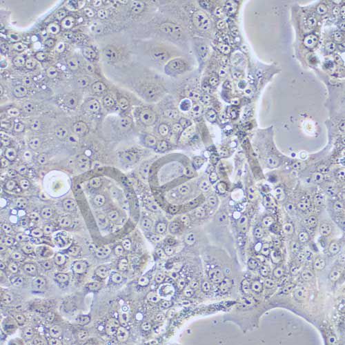 Capan-2 人胰腺癌細(xì)胞