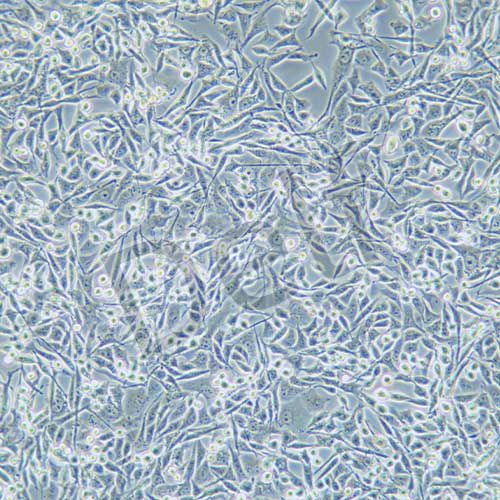 A-204人橫紋肌肉瘤細(xì)胞