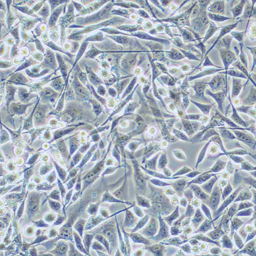 A-204人橫紋肌肉瘤細(xì)胞
