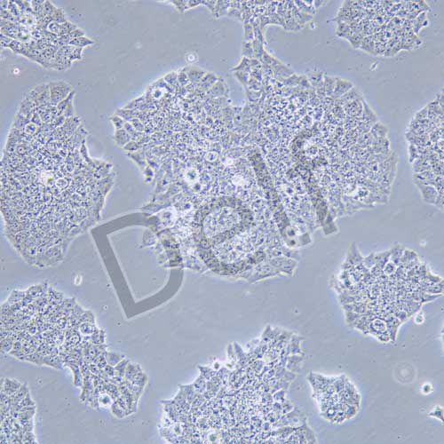 BT-474 人乳腺導(dǎo)管癌細胞