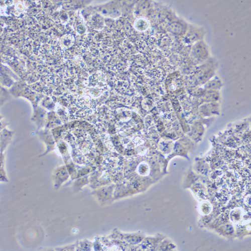 BT-474 人乳腺導(dǎo)管癌細胞