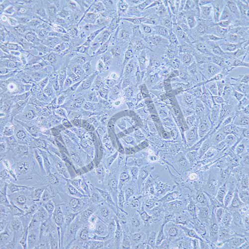 BT-549 人乳腺管癌細胞