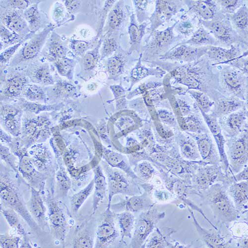 BT-549 人乳腺管癌細胞