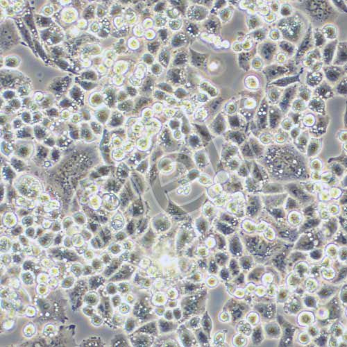 C-33A 人宮頸癌細(xì)胞
