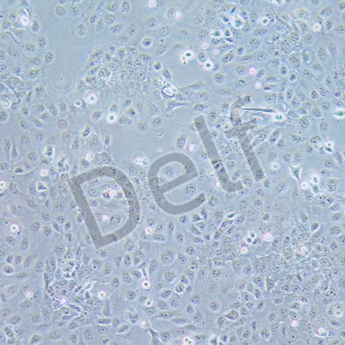 CASKI 人宮頸癌細(xì)胞