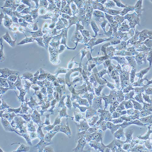 CBRH7919 大鼠肝癌細胞