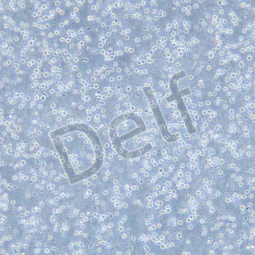 CCRF-CEM 人急性淋巴細(xì)胞白血病細(xì)胞