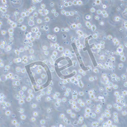 CCRF-CEM 人急性淋巴細(xì)胞白血病細(xì)胞