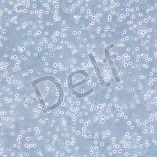 CEM/C1 人急性淋巴細胞白血病細胞