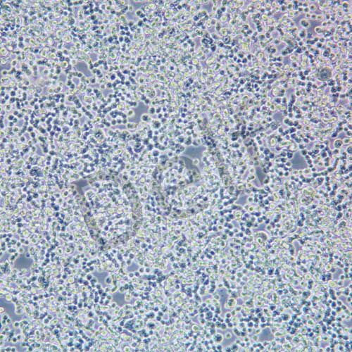 COLO320 人結(jié)直腸腺癌細(xì)胞