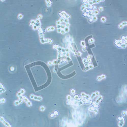 COLO320 HSR 人結(jié)直腸腺癌細(xì)胞