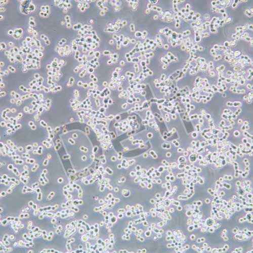 COLO320 DM人結(jié)直腸腺癌細胞