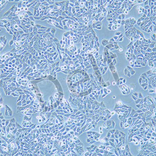 CX-1 人大腸癌細胞