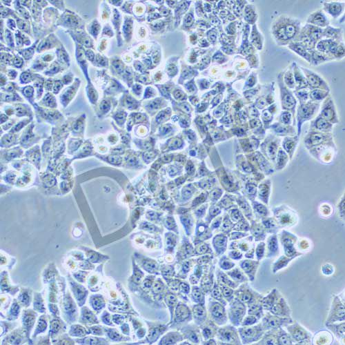 CX-1 人大腸癌細胞