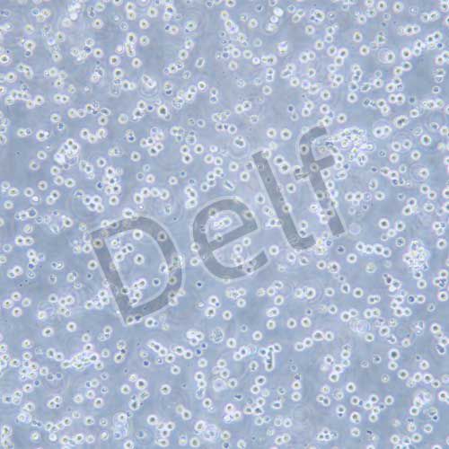 DAUDI 人Burkitt's淋巴瘤細胞