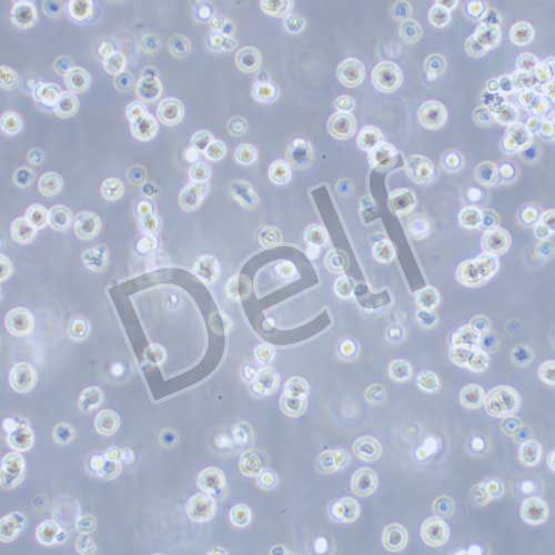 DAUDI 人Burkitt's淋巴瘤細胞