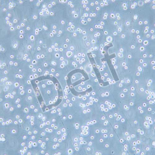 DB 人彌漫性大B細(xì)胞淋巴瘤細(xì)胞