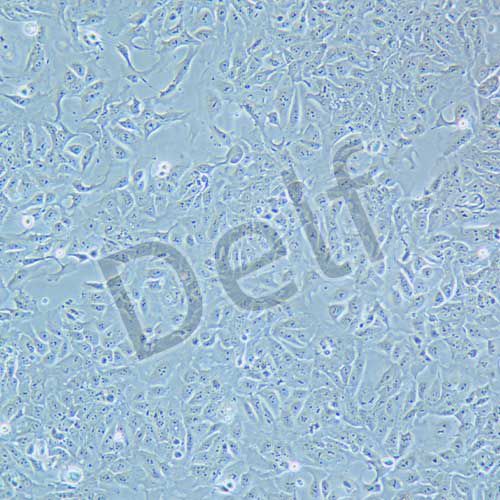 DLD-1 人結(jié)直腸腺癌上皮細胞