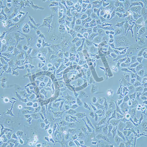 DMS 114 人小細胞肺癌細胞