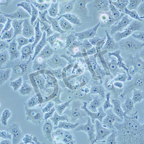 DMS 114 人小細胞肺癌細胞