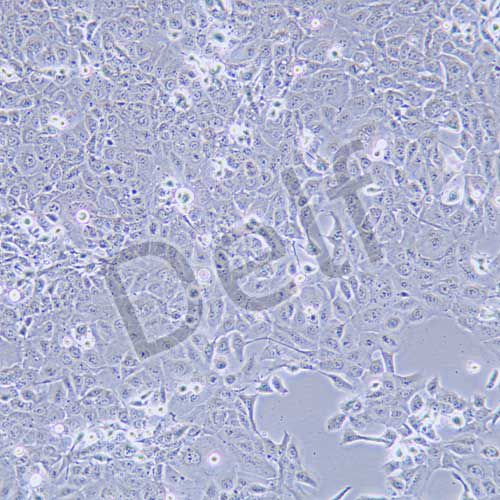 DU145 人前列腺癌細(xì)胞