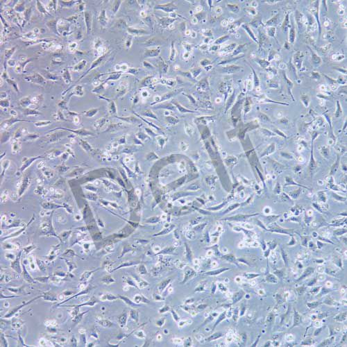 EA.hy926人臍靜脈細(xì)胞融合細(xì)胞