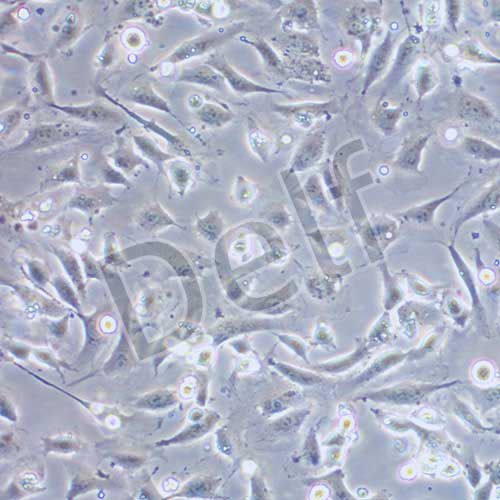 EA.hy926人臍靜脈細(xì)胞融合細(xì)胞