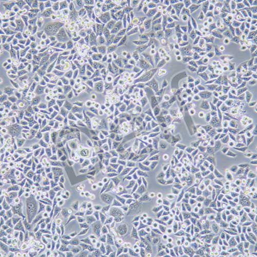 Eca-109 人食管癌細胞