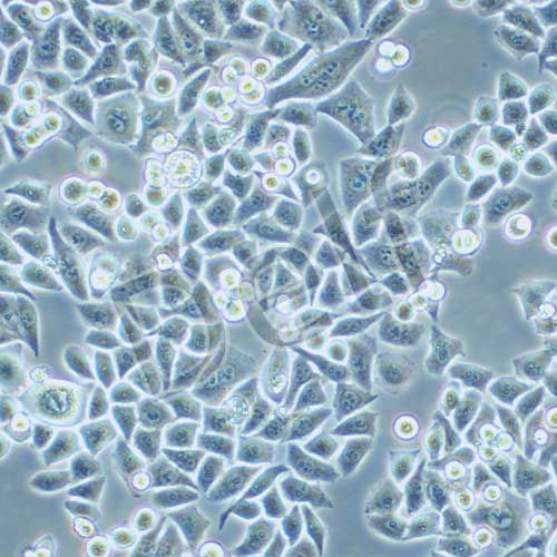 Eca-109 人食管癌細胞