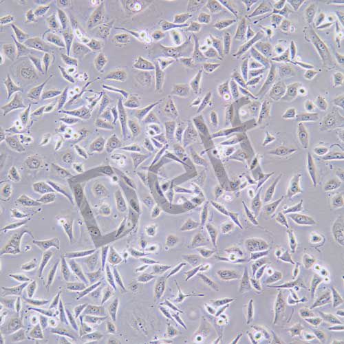 EJ （EJ-1）人膀胱癌細胞