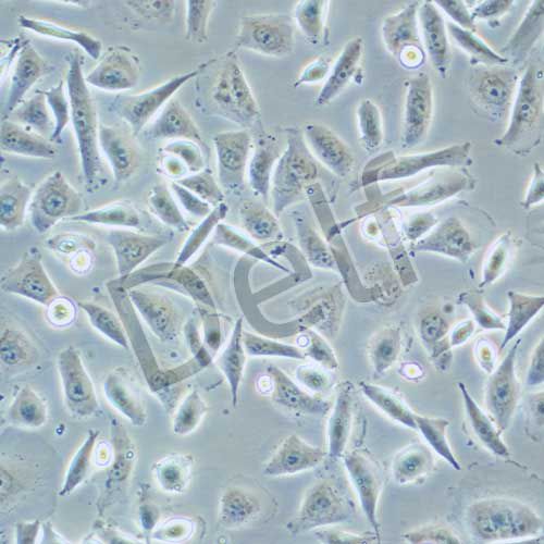 EJ （EJ-1）人膀胱癌細胞