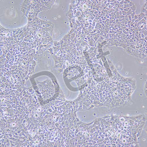 FADU 人咽鱗癌細胞