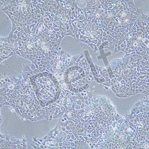 FADU 人咽鱗癌細胞