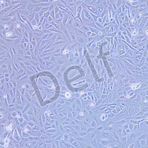 GBC-SD 人膽囊癌細胞