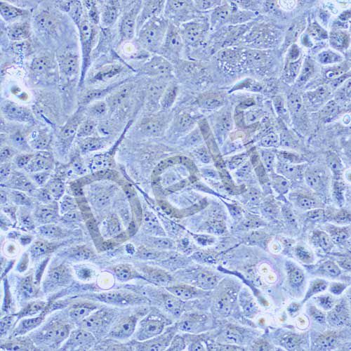 GBC-SD 人膽囊癌細胞