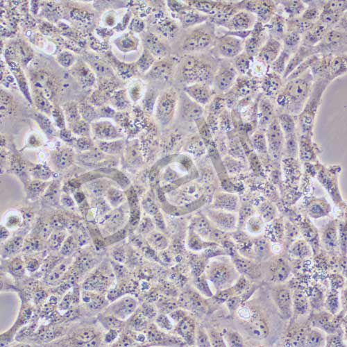 HBL-100 人整合SV40基因的乳腺上皮細(xì)胞