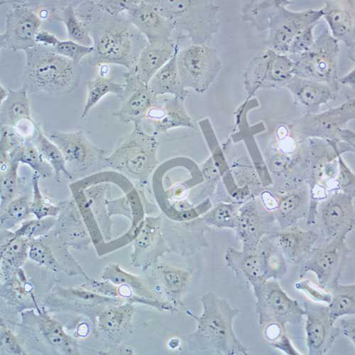 HCC38 人乳腺導(dǎo)管癌細(xì)胞