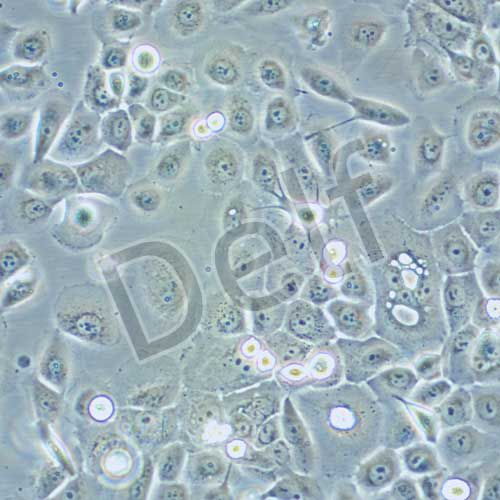 HCC-94 人子宮鱗癌細(xì)胞(高分化)