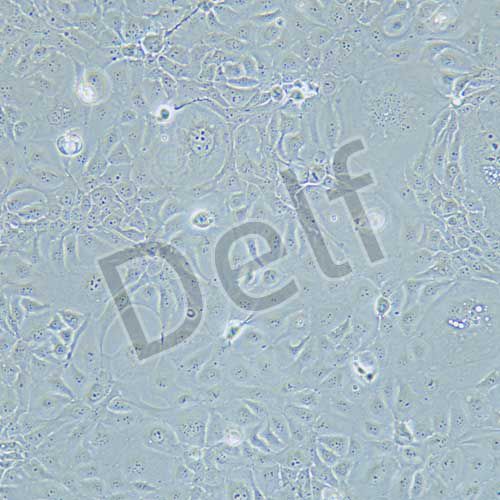 HCC1937 人乳腺癌細胞