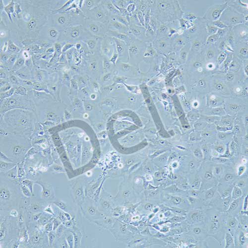 hccc-9810 人膽管細(xì)胞型肝癌細(xì)胞