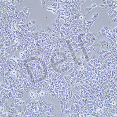 HCC-LM3 高轉(zhuǎn)移人肝癌細(xì)胞