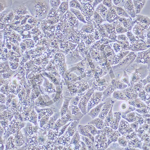 HCC-LM3 高轉(zhuǎn)移人肝癌細(xì)胞