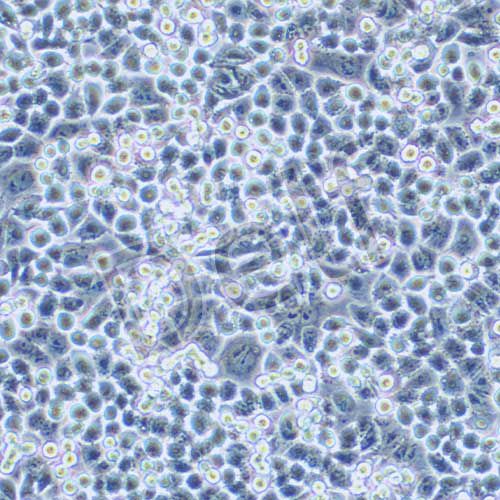 HCT-15 人結(jié)腸癌細胞
