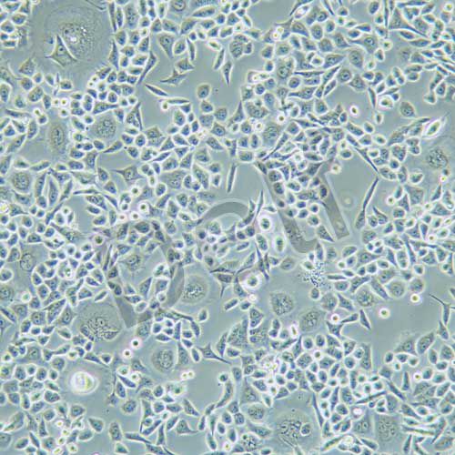 HCT-15/5FU 人結(jié)直腸癌氟尿嘧啶耐藥株