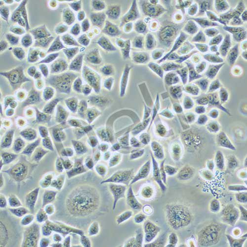 HCT-15/5FU 人結(jié)直腸癌氟尿嘧啶耐藥株