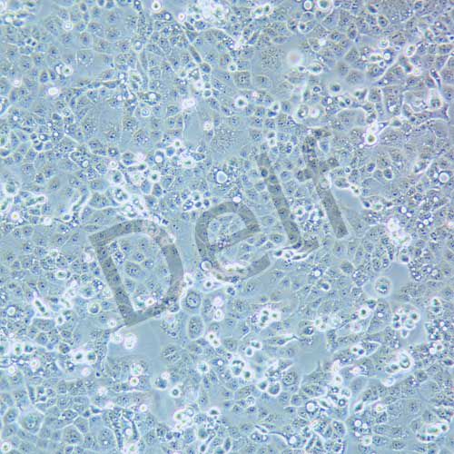 HEC-1-A 人子宮內(nèi)膜腺癌細(xì)胞