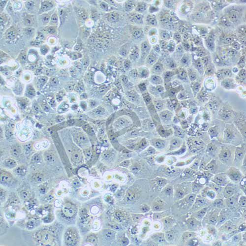 HEC-1-A 人子宮內(nèi)膜腺癌細(xì)胞