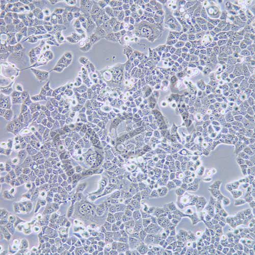 HEC-1-B 人子宮內(nèi)膜腺癌細(xì)胞